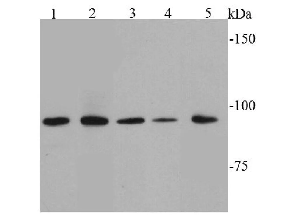STAT6 Rabbit Polyclonal Antibody - image 1