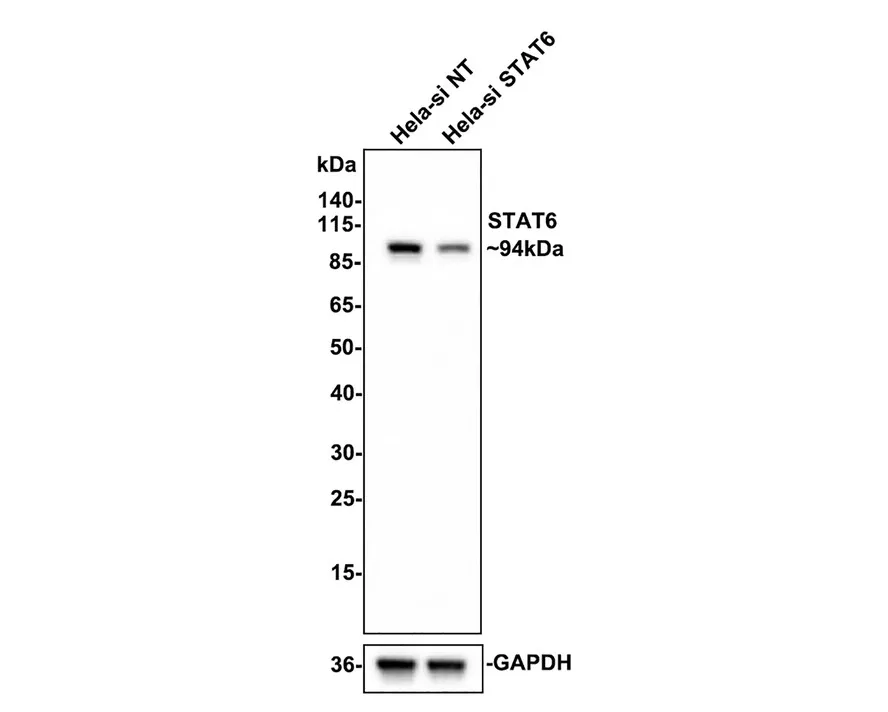 STAT6 Rabbit Polyclonal Antibody - image 2