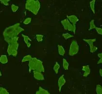 STAT6 Rabbit Polyclonal Antibody - image 3
