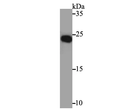 NGF Rabbit Polyclonal Antibody - image 1