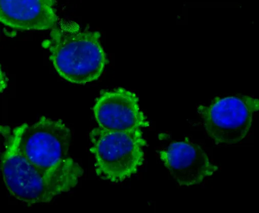 NGF Rabbit Polyclonal Antibody - image 2
