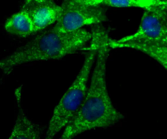 NGF Rabbit Polyclonal Antibody - image 3