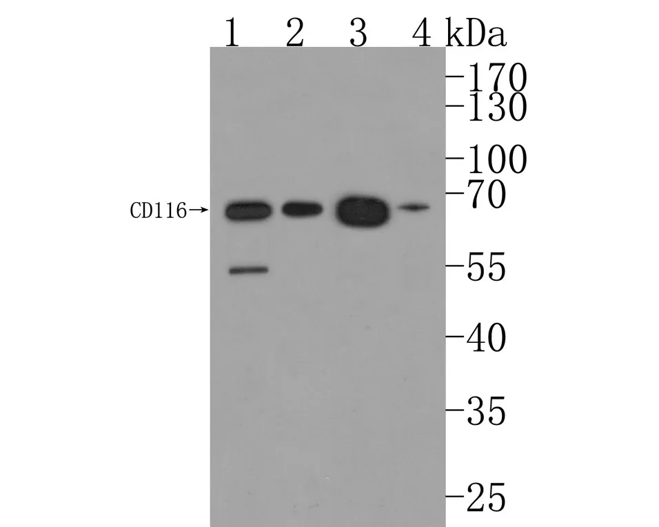 CD116 Rabbit Polyclonal Antibody - image 1