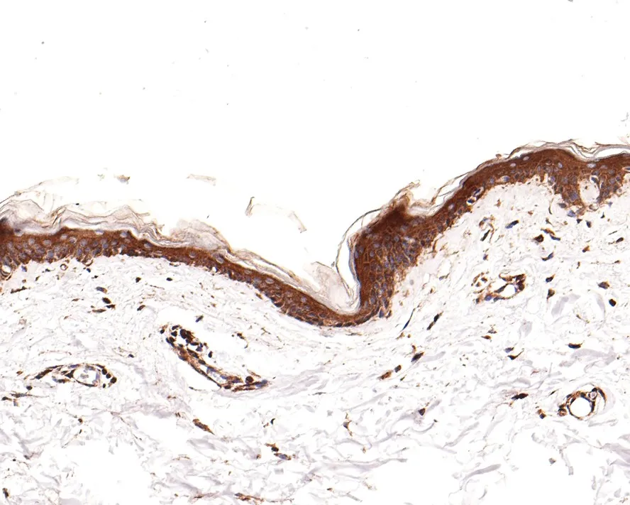 CD116 Rabbit Polyclonal Antibody - image 2