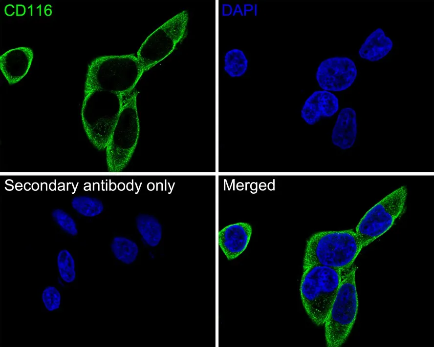 CD116 Rabbit Polyclonal Antibody - image 3