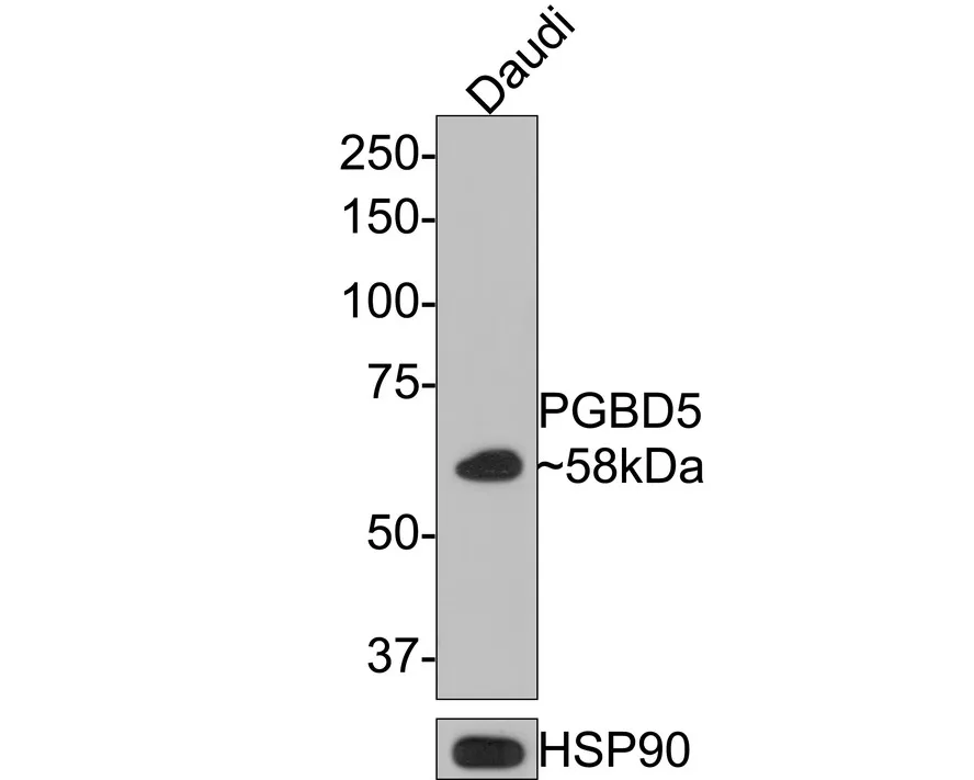 PGBD5 Rabbit Polyclonal Antibody - image 1