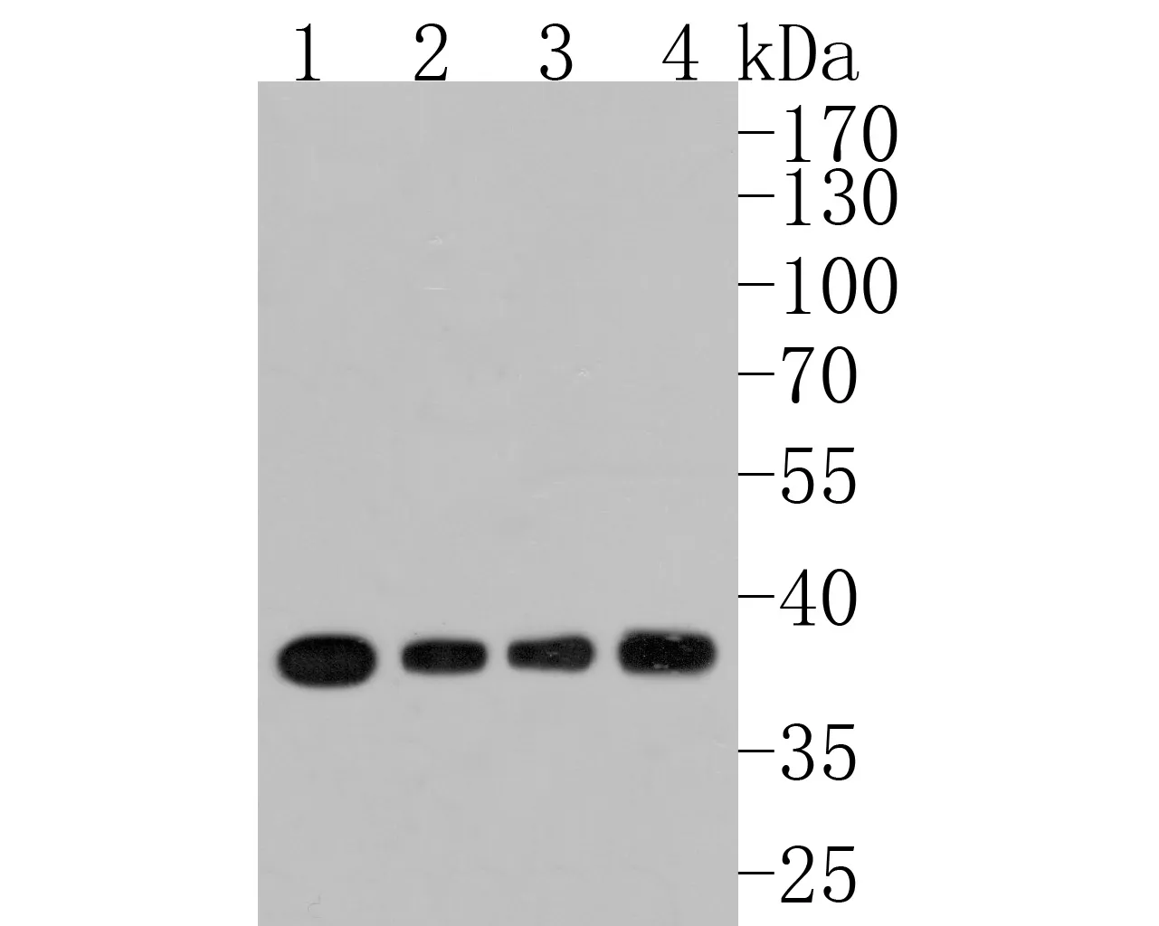 PPP1CA Rabbit Polyclonal Antibody - image 1