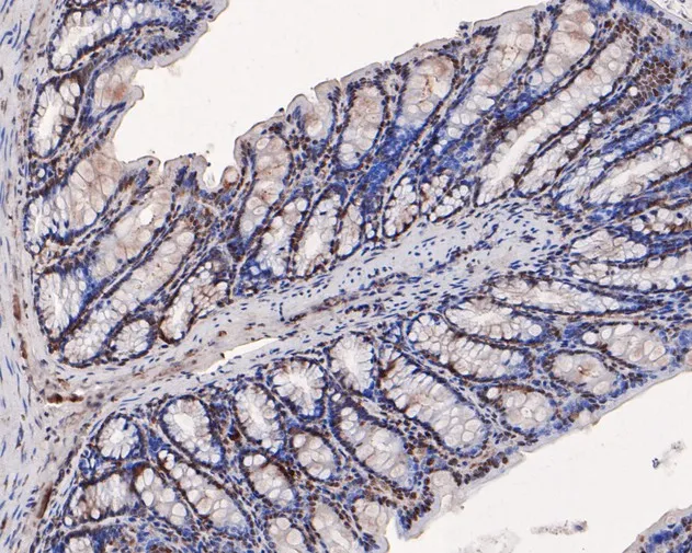 PPP1CA Rabbit Polyclonal Antibody - image 3