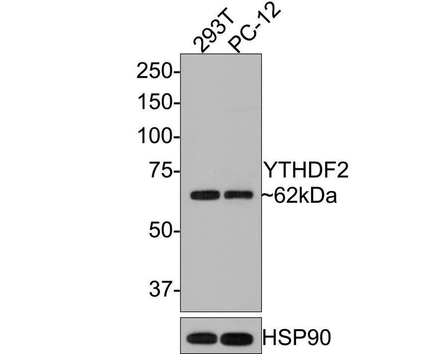 YTHDF2 Rabbit Polyclonal Antibody - image 1