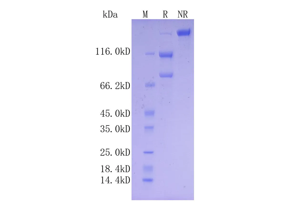 Mouse Complement C5, C-His Tag - image 1