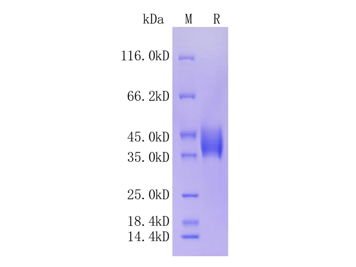 Mouse Complement Factor D, C-His Tag - image 1