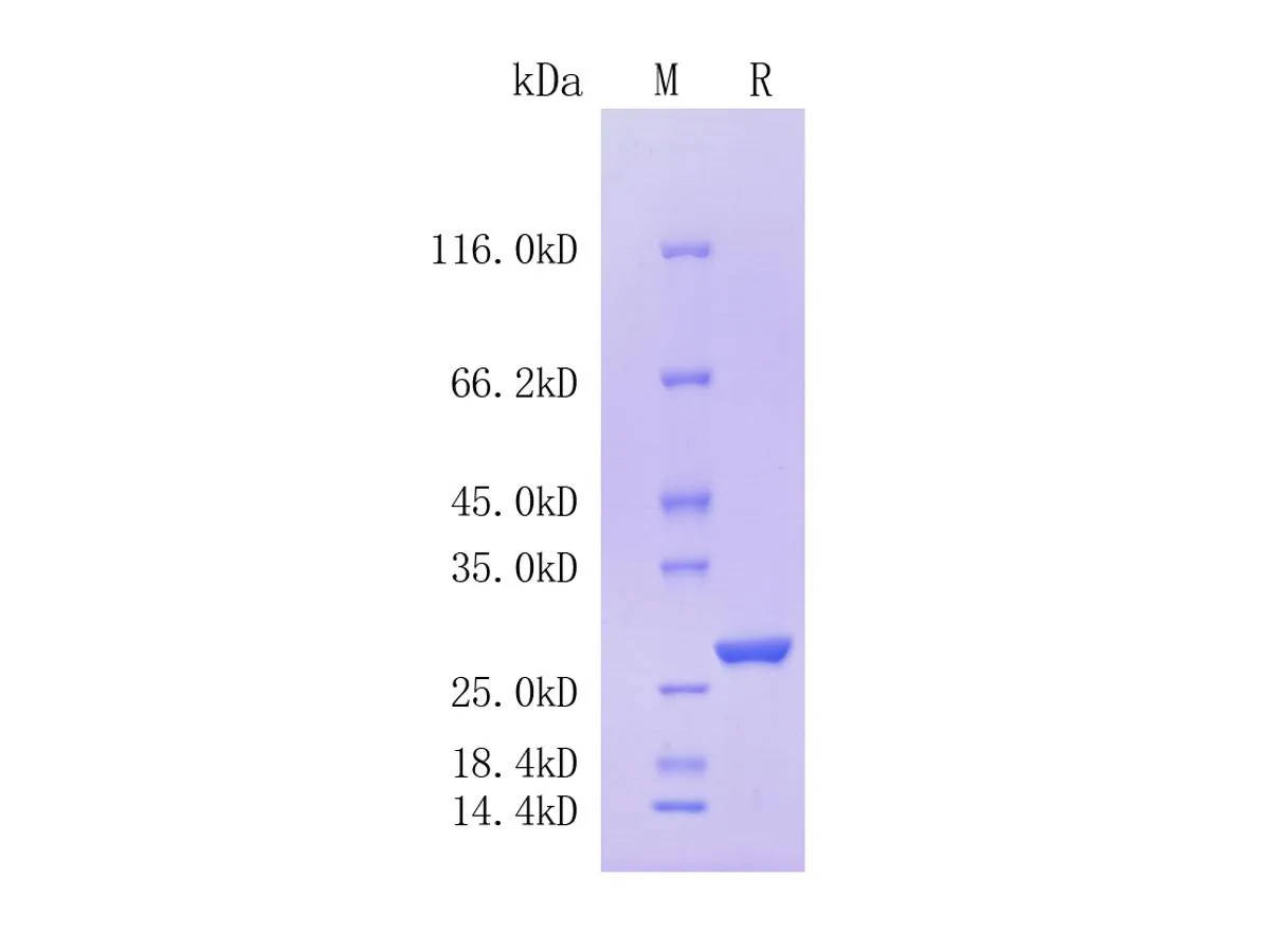 Human Complement Factor D/CFD, C-His Tag - image 1