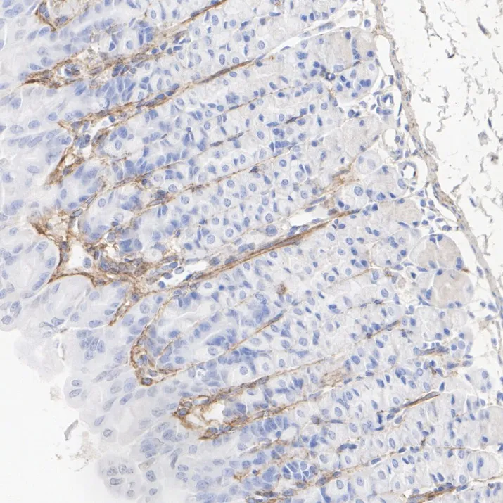 Fibronectin Recombinant Rabbit monoclonal Antibody - image 6
