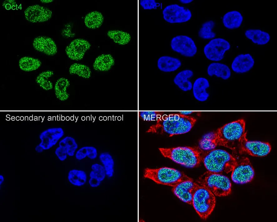 IPS Cell Reprogramming Antibody Kit - image 1