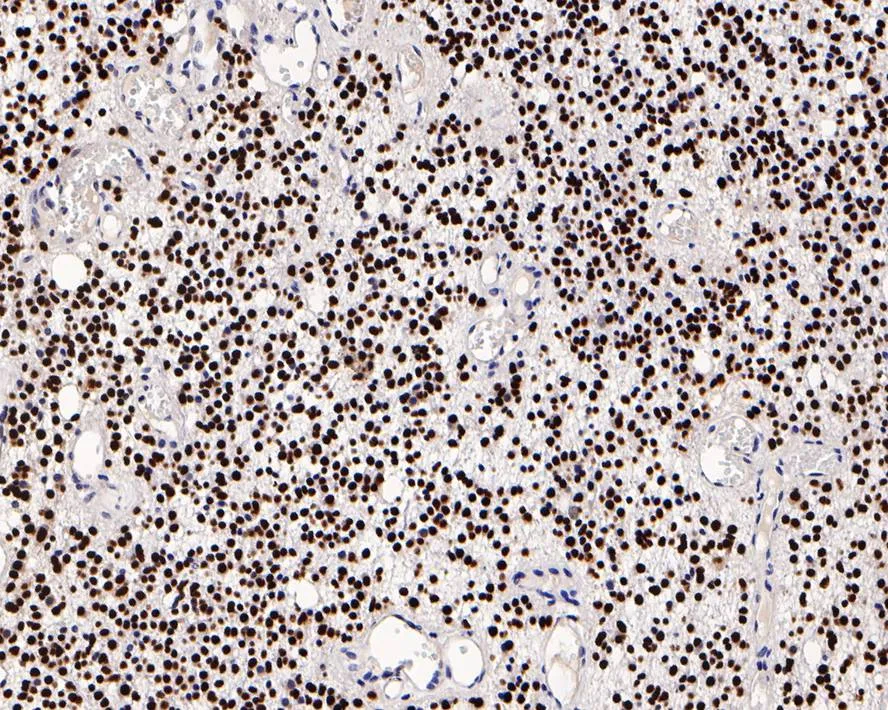 IPS Cell Reprogramming Antibody Kit - image 3
