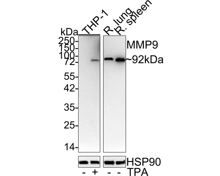 ECM Profiling Antibody Sampler Kit - image 1