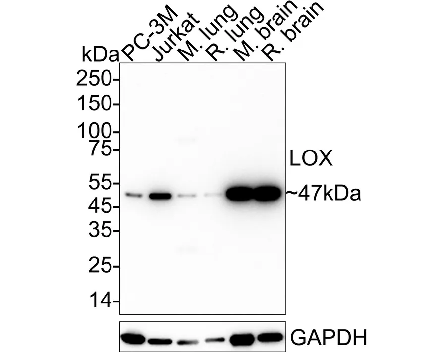 ECM Profiling Antibody Sampler Kit - image 4