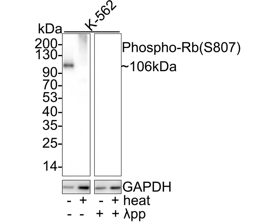 Rb Antibody Sampler Kit - image 1