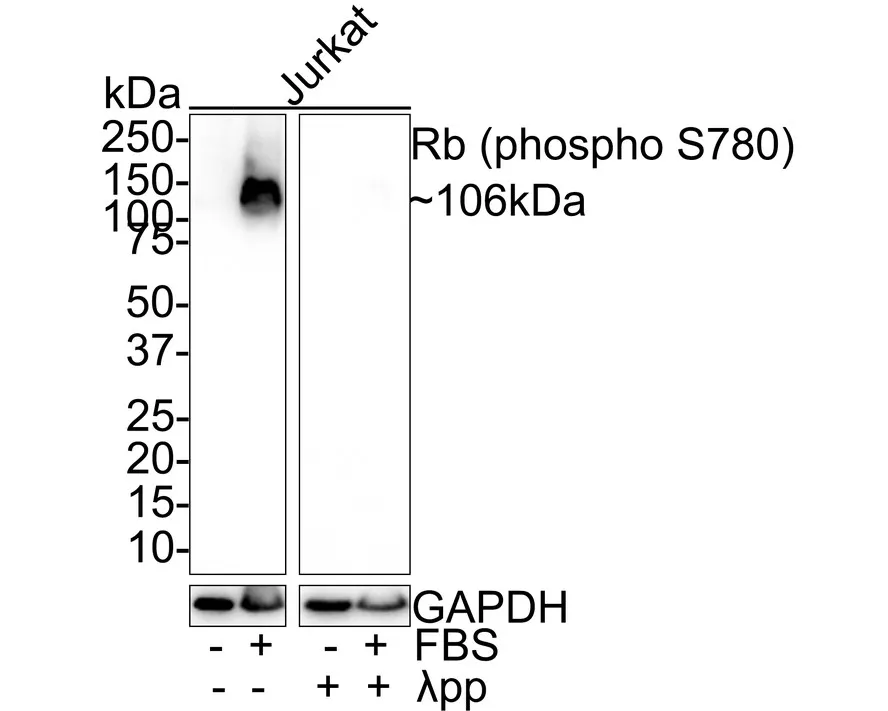 Rb Antibody Sampler Kit - image 2