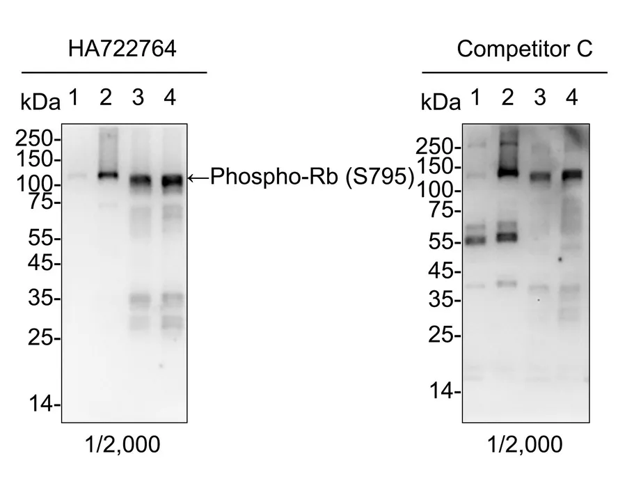 Rb Antibody Sampler Kit - image 3