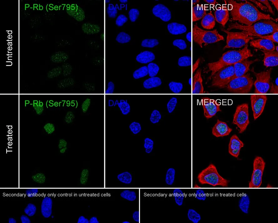 Rb Antibody Sampler Kit - image 4